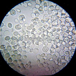 Baker's yeast up close and personal (marks are 1 µM apart for scale). Photo by Bob Blaylock, http://bit.ly/ULp0ZO.